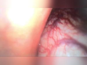 Nudo Animale Donna: Il Nodo Dentro