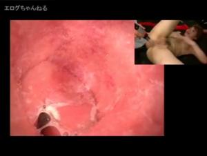 Anal Salope & Chien : Insertion Endo Live X