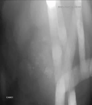 Caméra IP - Irlande